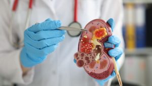 Casos de insuficiência renal cresceram em 2024 - Crédito: Freepick
