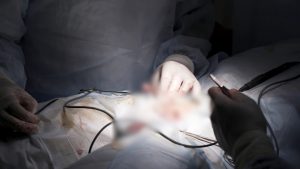 Câncer de pênis: a cada ano, cerca de 486 homens têm o órgão genital amputado pelo SUS