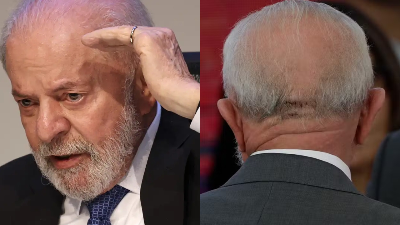 Lula alta médica Lula alta médica