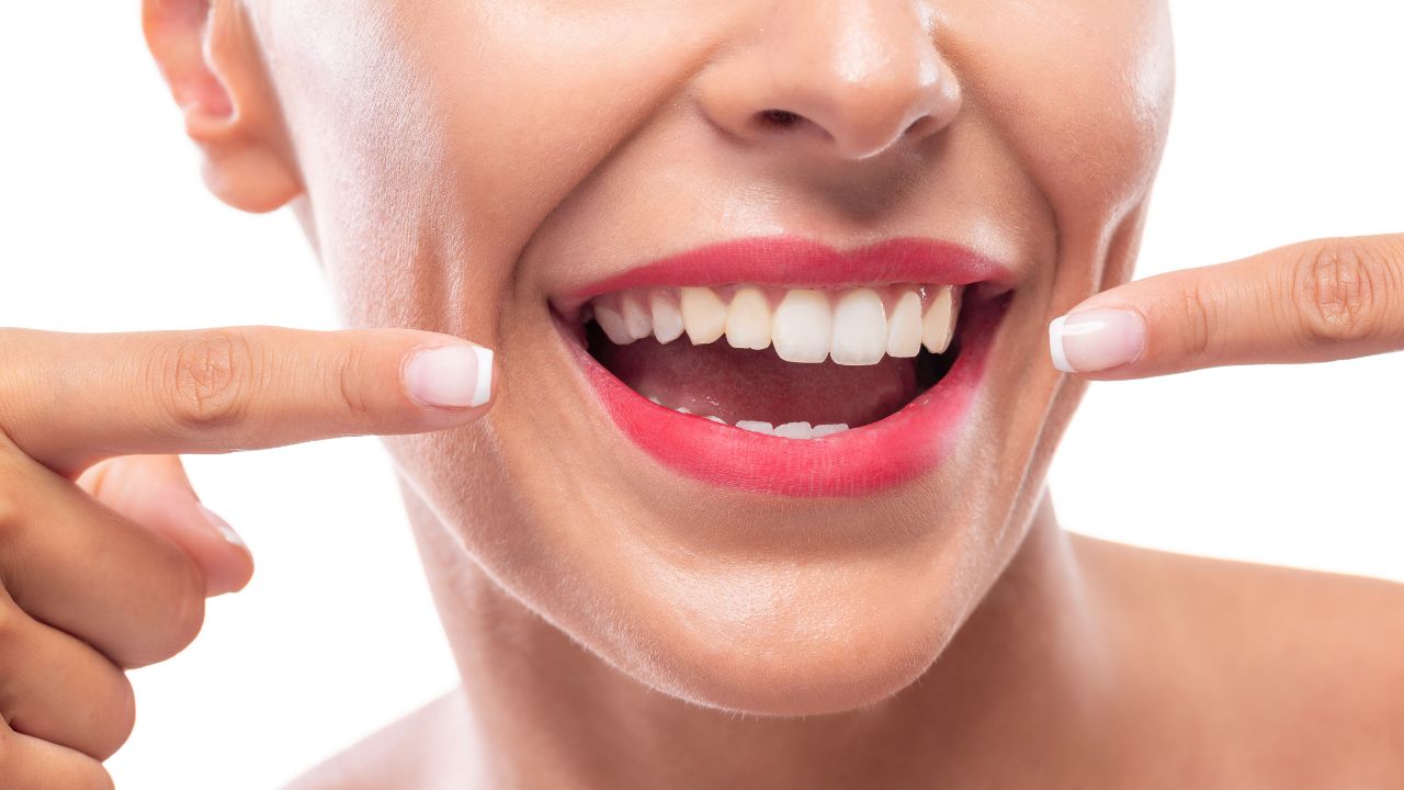 dentes-claros-receita-caseira-clareamento Receita promete clarear os dentes,prevenir cáries, gengivite, inflamações e até mesmo placas bacterianas - Crédito: Freepik