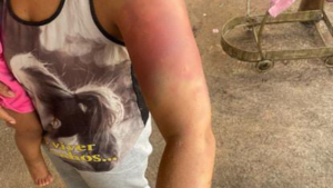 Mulher é agredida por companheiro após atropelar jovem durante discussão motivada por ciúmes