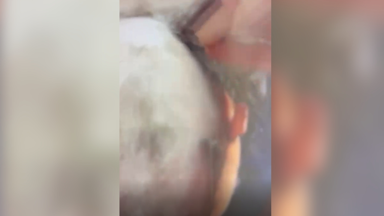 Cabelo sendo raspado