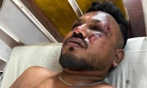 Vishwash Kumar Ramesh, britânico de 40 anos, que escapou da queda de avião na Índia com ferimentos no rosto, no peito e nos pés.
