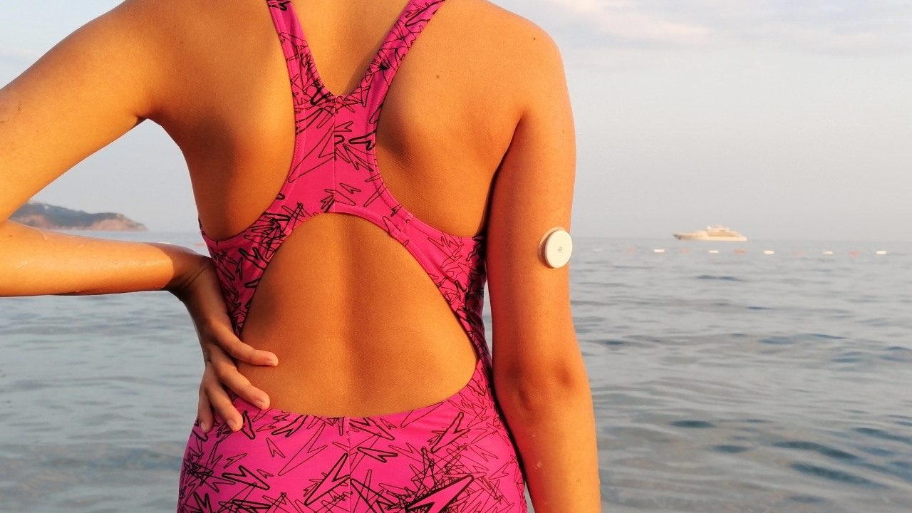 Mulher com sensor de glicose no braço para monitorar o controle do diabetes