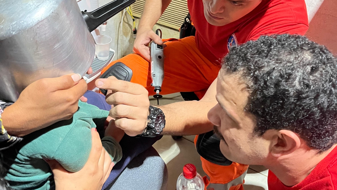 panela de pressão na cabeça de menino de 2 anos