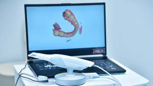 Com o uso de inteligência artificial e escaneamento 3D, Hoje, é possível planejar todo o tratamento ortodôntico virtualmente.