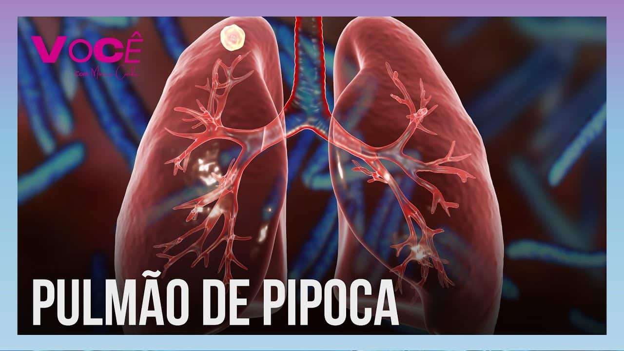 Pulmão de pipoca: uma doença silenciosa e que tem entre as causas o uso ...