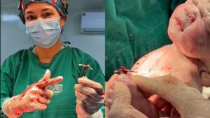 Bebê nasce com DIU na mão em Goiás