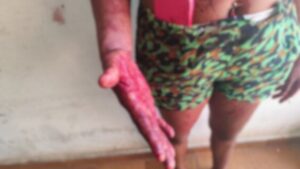 Esfaqueamento em Uberaba: mulher reage a ataque dentro de motel