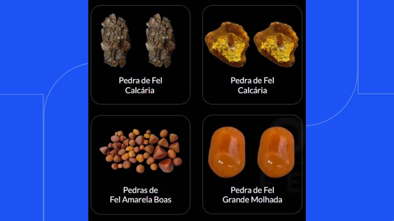 Pedra de fel vale fortuna e já foi alvo de furto em Araguari