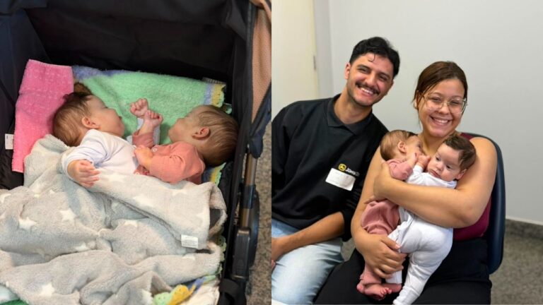 Gêmeas Siamesas em Goiânia no hospital especializado