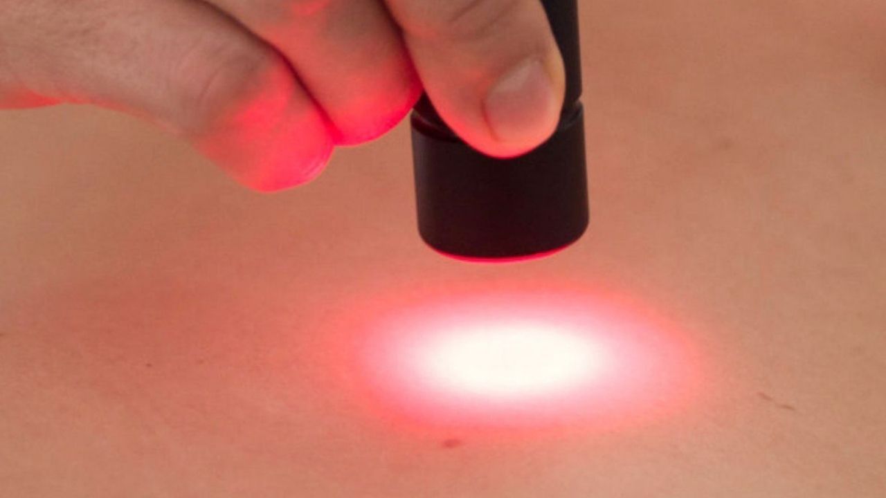 laser acupuntura