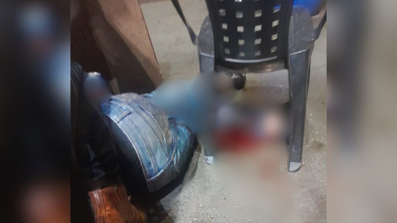 Motociclista fica ferido Motociclista fica ferido