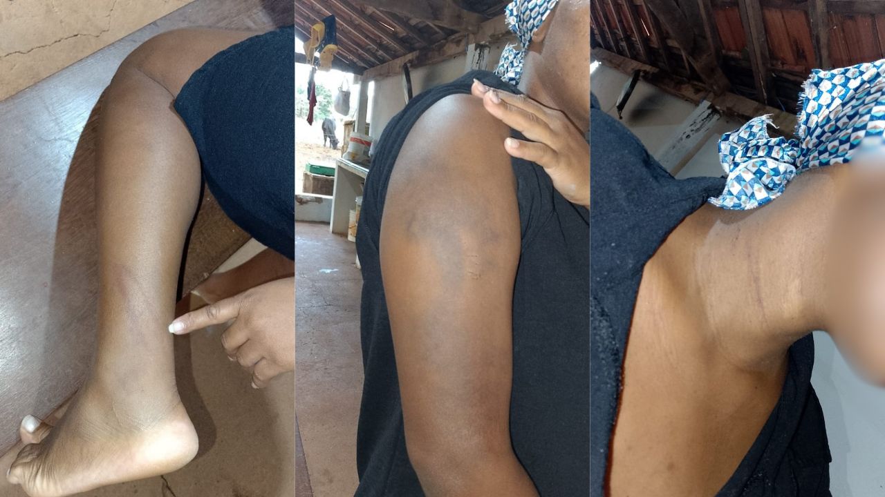 mulher agredida e que teve cabeça raspada pelo marido